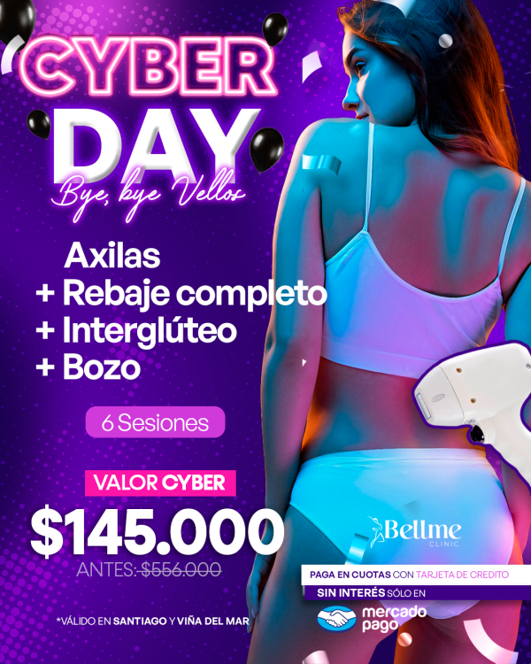 Axilas +Rebaje Completo + Interglúteo + Bozo