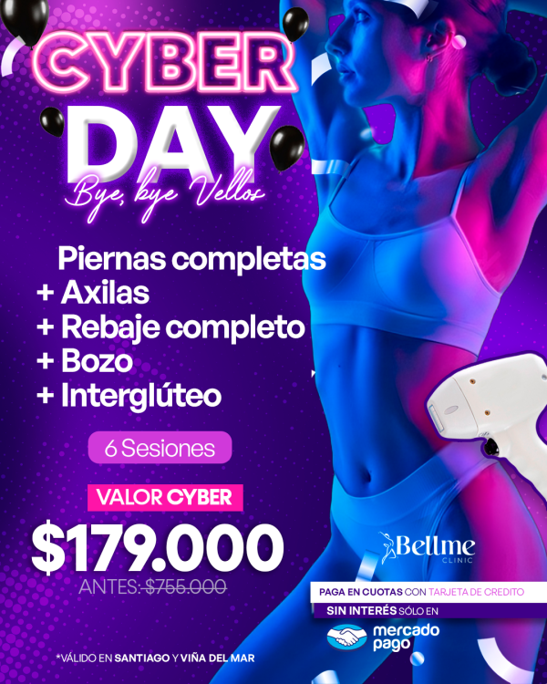 Pienas completas + Axilas + Rebaje completo + Bozo + Interglúteo