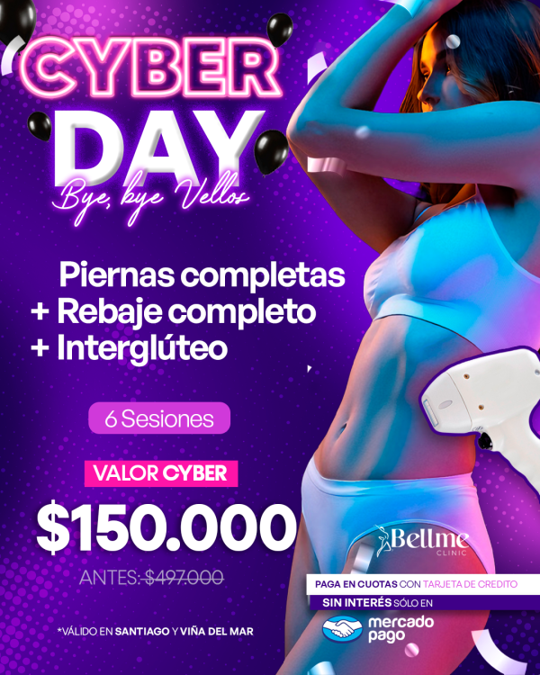 Piernas Completas + Rebaje Completo + Interglúteo