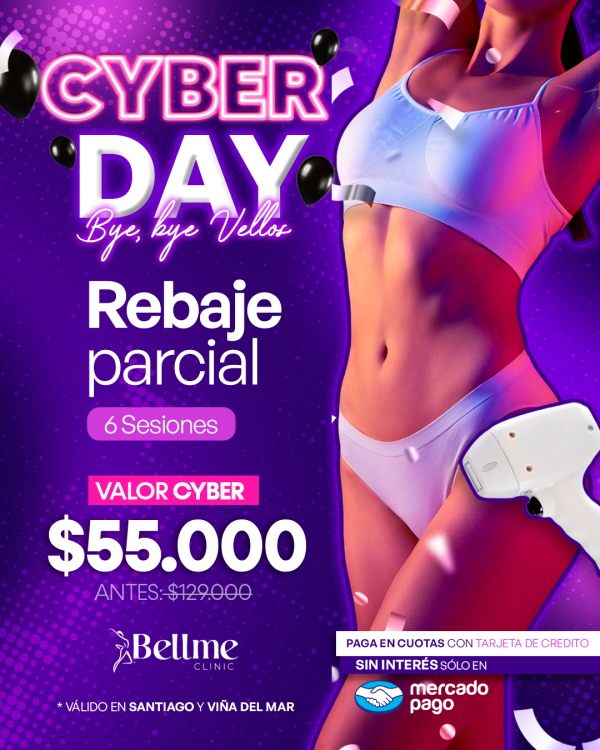 Rebaje Parcial