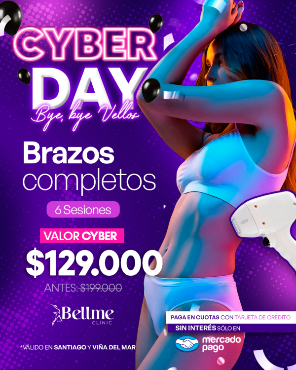 Brazos Completos