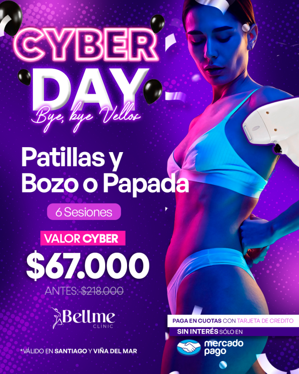 Patillas y Bozo o Papada