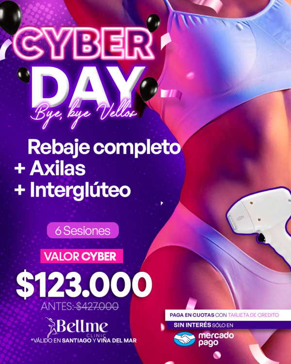 Rebaje Completo + Axilas + Interglúteo