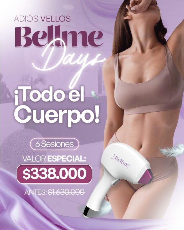 Todo el cuerpo